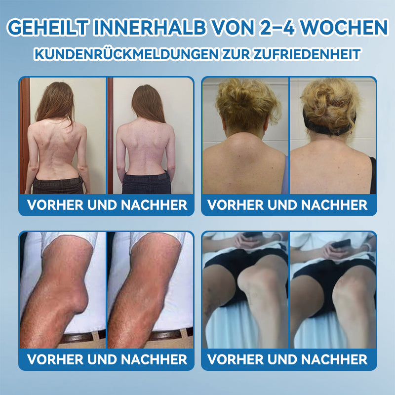 |✨Offizieller Shop✨| 𝘾𝙧𝙤𝙖𝙞𝙚® 🇩🇪 𝘽𝙋𝘾-157 𝙂𝙚𝙡𝙚𝙣𝙠𝙝𝙚𝙞𝙡𝙘𝙧𝙚𝙢𝙚 💪🦴𝘽𝙚𝙝𝙖𝙣𝙙𝙚𝙡𝙩 𝘼𝙧𝙩𝙝𝙧𝙞𝙩𝙞𝙨, 𝙉𝙚𝙪𝙧𝙤𝙥𝙖𝙩𝙝𝙞𝙚, 𝙍𝙝𝙚𝙪𝙢𝙖, 𝙎𝙥𝙤𝙧𝙩𝙫𝙚𝙧𝙡𝙚𝙩𝙯𝙪𝙣𝙜𝙚𝙣 & 𝙢𝙚𝙝𝙧 🏆