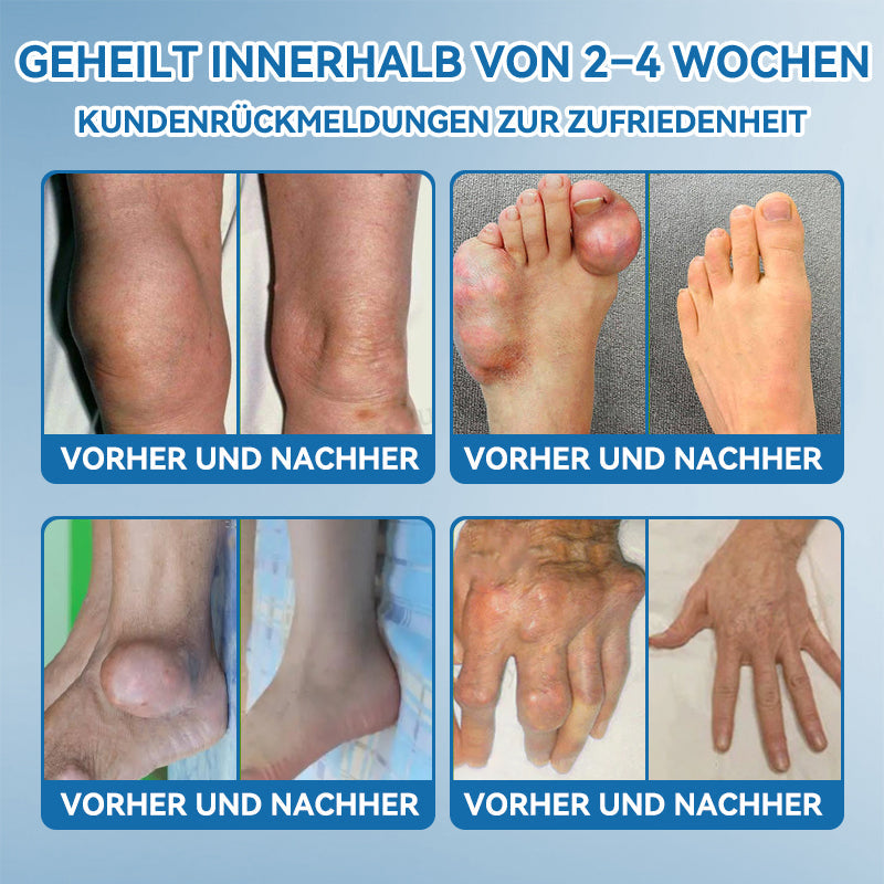 |✨Offizieller Shop✨| 𝘾𝙧𝙤𝙖𝙞𝙚® 🇩🇪 𝘽𝙋𝘾-157 𝙂𝙚𝙡𝙚𝙣𝙠𝙝𝙚𝙞𝙡𝙘𝙧𝙚𝙢𝙚 💪🦴𝘽𝙚𝙝𝙖𝙣𝙙𝙚𝙡𝙩 𝘼𝙧𝙩𝙝𝙧𝙞𝙩𝙞𝙨, 𝙉𝙚𝙪𝙧𝙤𝙥𝙖𝙩𝙝𝙞𝙚, 𝙍𝙝𝙚𝙪𝙢𝙖, 𝙎𝙥𝙤𝙧𝙩𝙫𝙚𝙧𝙡𝙚𝙩𝙯𝙪𝙣𝙜𝙚𝙣 & 𝙢𝙚𝙝𝙧 🏆